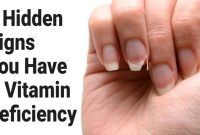 What Are The Signs Of Vitamin Deficiency You Should Know